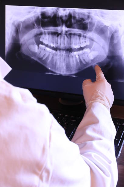 Best Root Canal Emergency Dentist  in Laurel, DE