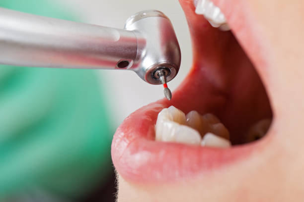 Best Tooth Infection Emergency Dentist  in Laurel, DE